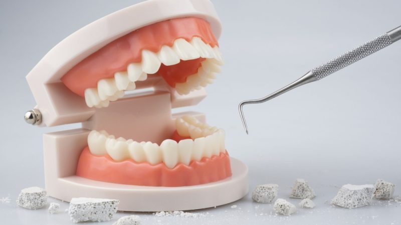 DENTAL PLAQUE EXPLAINED: WHAT EVERY PARENT SHOULD KNOW